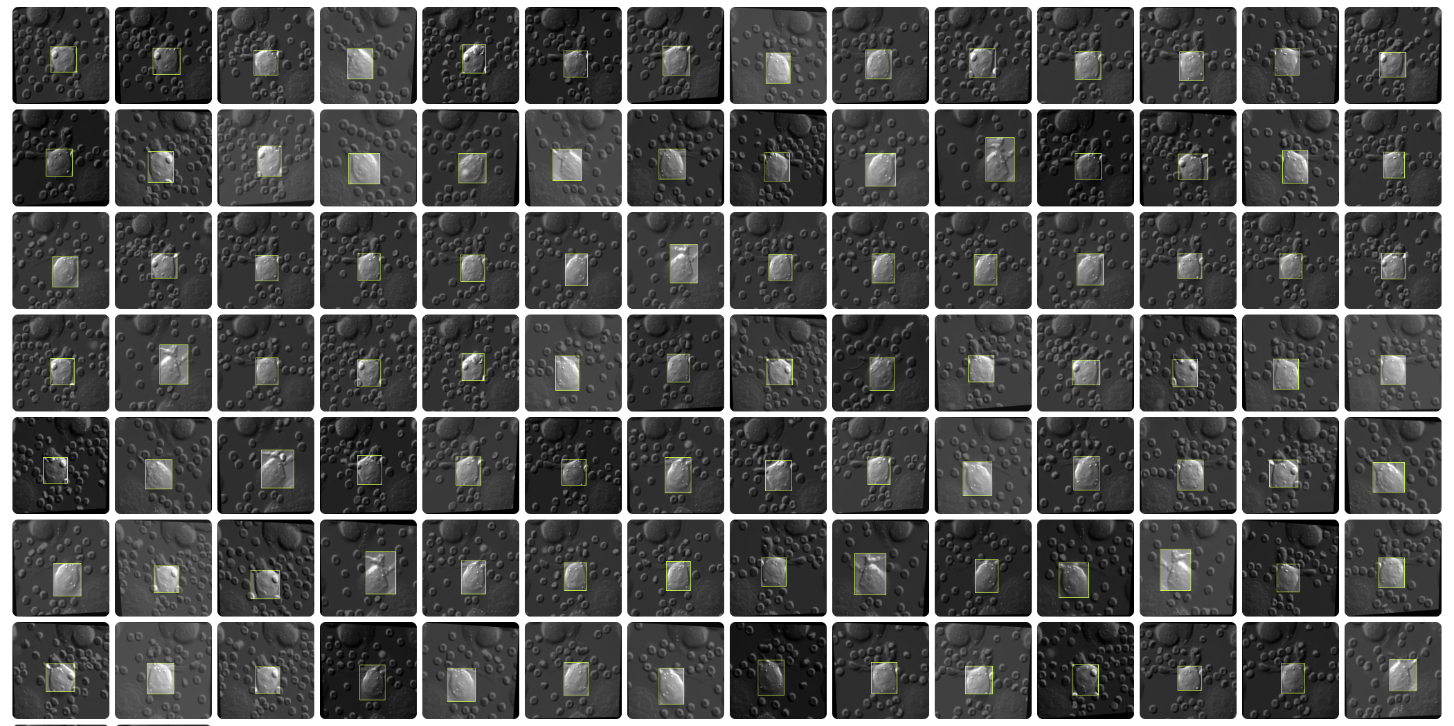 AI Medical Imaging