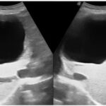 diagnostics-13-01127-g004-550